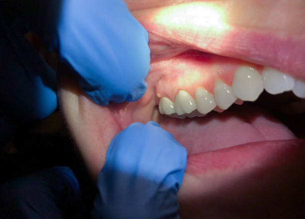 Russellville, KY Emergency Dentist Pros
