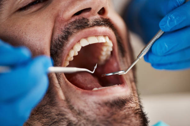 Best Emergency Treatment for Toothache in Russellville, KY