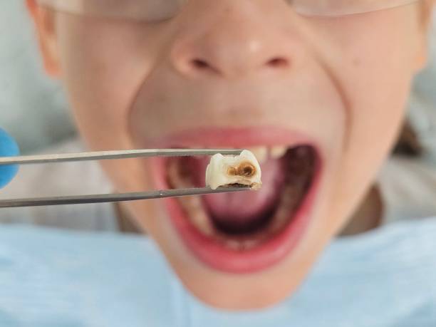 Best Emergency Dental Surgery in Russellville, KY