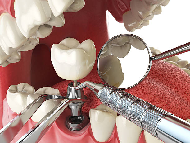 Best After-Hours Emergency Dentist in Russellville, KY