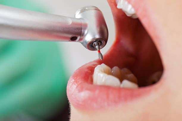 Best Walk-In Emergency Dentist in Russellville, KY